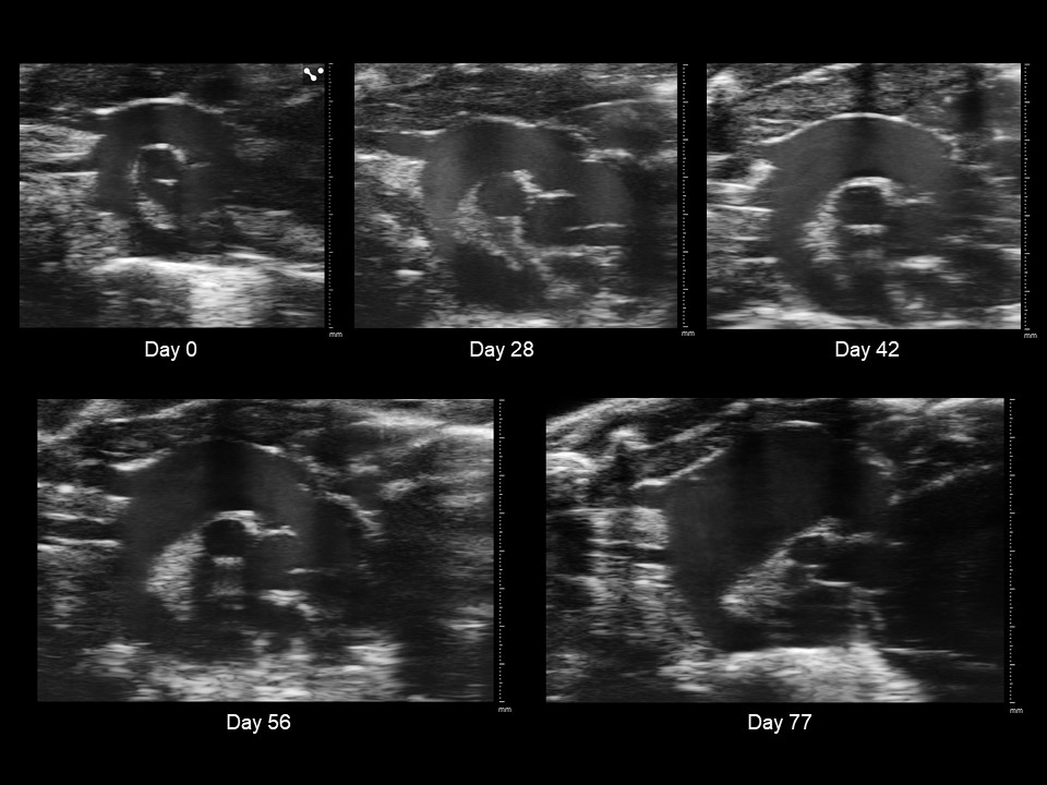 Progression of a Murine Thoracic Aortic Aneurysm
